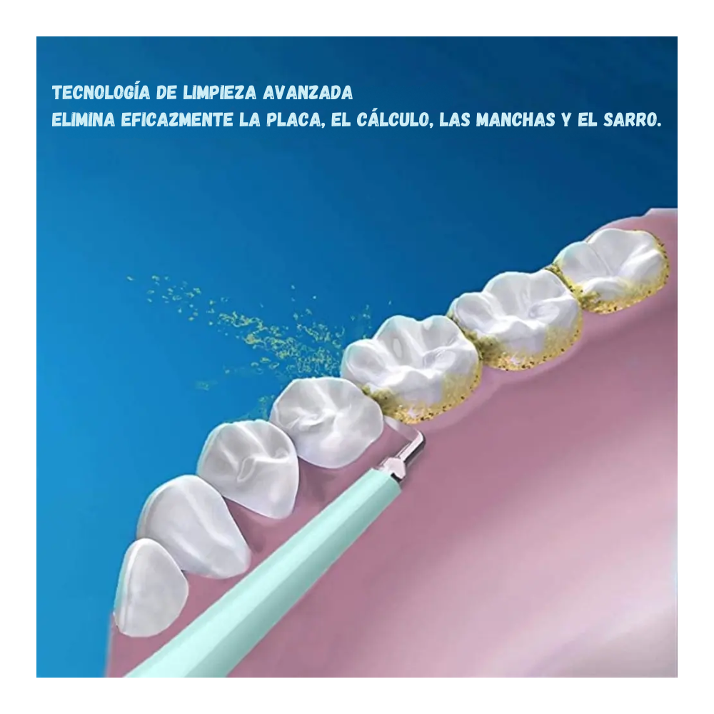 Cepillo Limpiador y Removedor Sarro Dental Ultrasónico Recargable